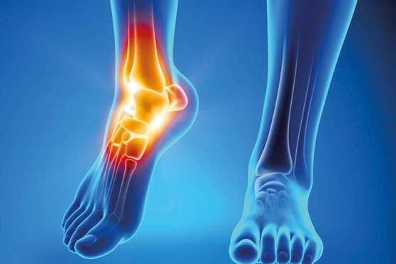 دردهای مفصلی را چطور کم کنیم؟